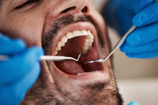 Best Emergency Tooth Extraction in Russell Springs, KY