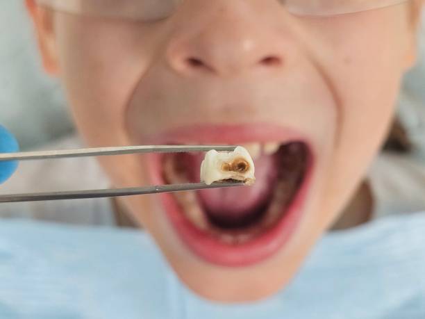Best Walk-In Emergency Dentist in Russell Springs, KY