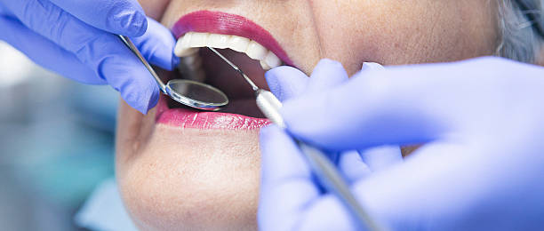 Best Emergency Wisdom Teeth Removal in Russell Springs, KY